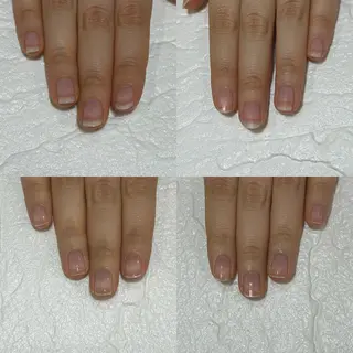 ネイル 自爪育成・巻き爪 補正講師　津蔵のネイルデザイン