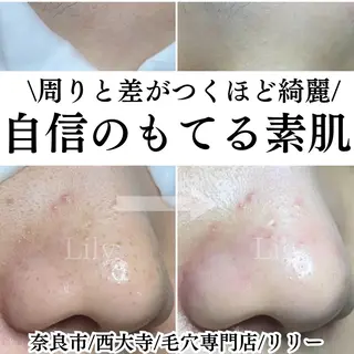 Salon Lily MARIのエステ・リラクイメージ