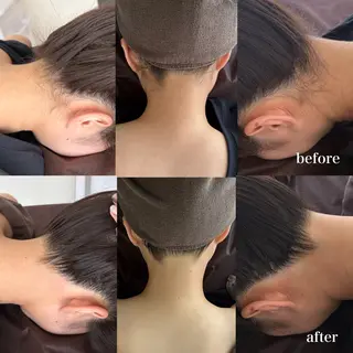 美肌脱毛サロン Darius 上野所属・とよの みゆのエステ・リラクイメージ