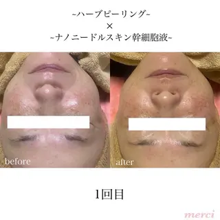 salon merci和泉のエステ・リラクイメージ