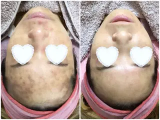 Knine所属・Knine 心斎橋店のエステ・リラクイメージ