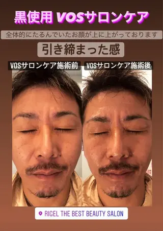 メンズ エステ.まつげ.小顔 眉毛.プラズマ.脱毛のマツエク・マツパデザイン