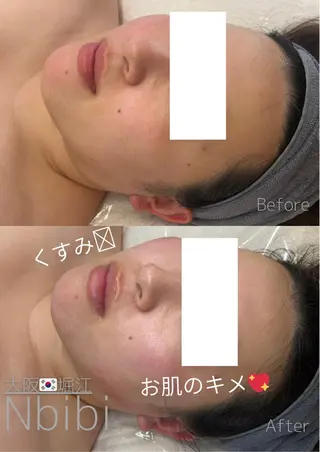 韓国🇰🇷価格 サロン_Nbibiのエステ・リラクイメージ