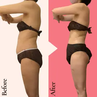 痩身ダイエット専門店 プレシャスのエステ・リラクイメージ