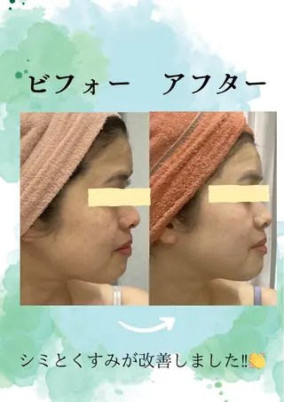 エステ♡Eden Asamiのエステ・リラクイメージ