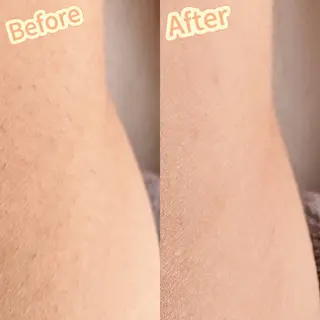 Hit. シュガーリング豊橋のエステ・リラクイメージ