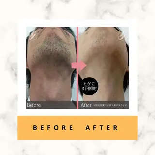 脱毛/痩身/頭皮ケア GLYCINEのエステ・リラクイメージ