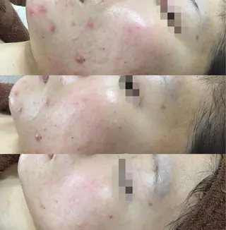 SALON BioBioのエステ・リラクイメージ