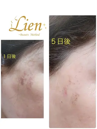 Lien オーナー　山口智嘉のエステ・リラクイメージ