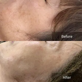 Beauty Salon Ciel Chiba所属・BeautySalo nCielChibaのエステ・リラクイメージ