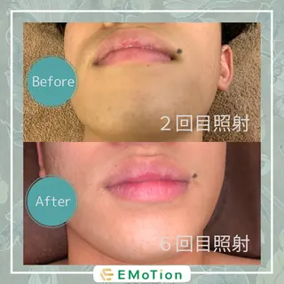 メンズ メンズ脱毛サロン EMoTionのエステ・リラクイメージ