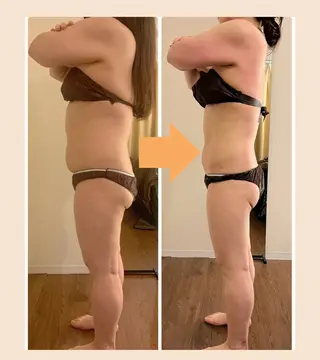 bellissimo 【ベリッシモ】所属・ちひろ　痩身/ハーブ bellissimoのエステ・リラクイメージ