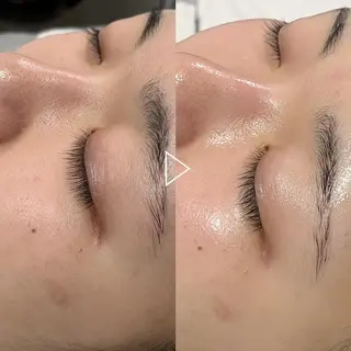 肌質改善＋小顔 🤍Kyrieのエステ・リラクイメージ