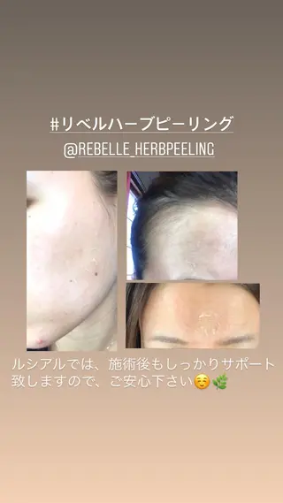 グランデ ルシアルのエステ・リラクイメージ