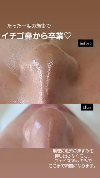 Premier 所属・寺西 さくらのエステ・リラクイメージ