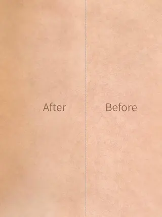 hug me. シュガーリングサロンのエステ・リラクイメージ