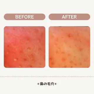 清水 唯のエステ・リラクイメージ