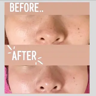 CEサロンblanc bebe所属・高村 有紀のエステ・リラクイメージ