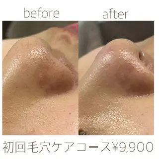 田辺🌿毛穴ケア サロンリテルナのエステ・リラクイメージ