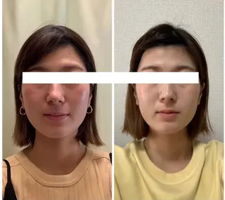 丸顔さんの救世主 高田 くみのエステ・リラクイメージ