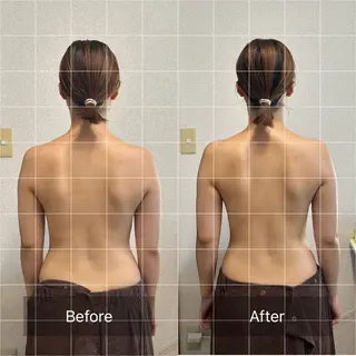 肩こり改善 専門店Fleuriのエステ・リラクイメージ