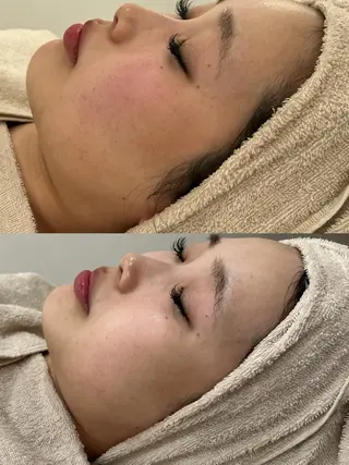 エステサロンTug高知駅前店所属・Tug 高知駅前店/ NANAMI🌐のエステ・リラクイメージ