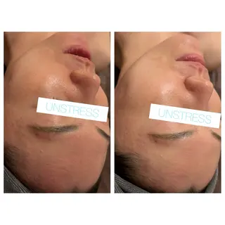 ☆痩身/小顔☆ 結果出します☆のエステ・リラクイメージ