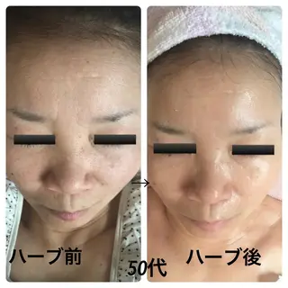 フェアリーローズ所属・fairyrose organicエステのエステ・リラクイメージ