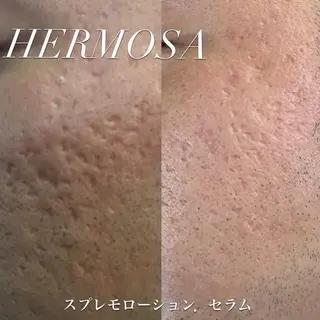 オールハンド フェイシャルのエステ・リラクイメージ