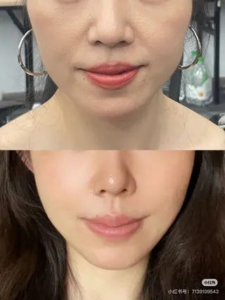 マツエク・マツパ aliaハイフ&水光ジェットサロン所属・aliaハーブ水光店 エステティシャン募集のエステ・リラクイメージ