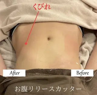 ブライダルサロン ｜Lino【堀江】のエステ・リラクイメージ