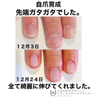 ネイル NAIL SALON ｔｏｇｇｙのネイルデザイン