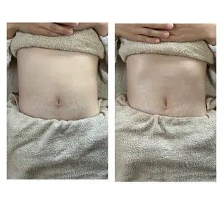 Mafett （マフィット）のエステ・リラクイメージ