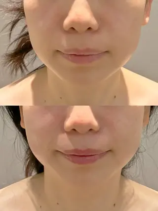 Hair&Spa リーノ所属・折原 あやのエステ・リラクイメージ