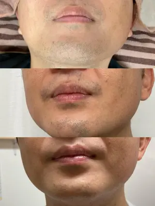 メンズ トータルビューティー サロンCherie2のエステ・リラクイメージ