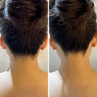 うなじ脱毛/美肌脱毛 LABELのエステ・リラクイメージ