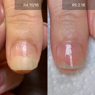 ネイル 木村 千晴のネイルデザイン