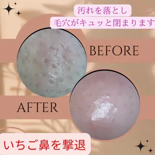 akua... 【肌質管理専門】のその他イメージ