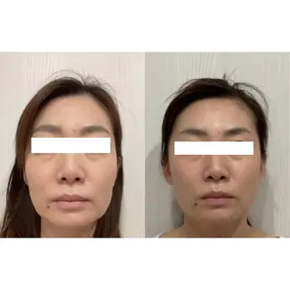 PARAFUSE.札幌店Brange所属・佐藤 陽子のエステ・リラクイメージ