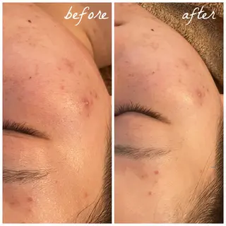 メンズ メナード岐阜市茜部 杉浦のエステ・リラクイメージ