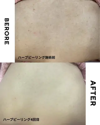 肌質改善専門サロン Bellmi/心斎橋のエステ・リラクイメージ