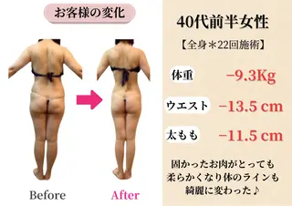 Belle White所属・本格痩身＊肌質改善＊ BelleWhiteのエステ・リラクイメージ