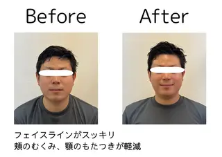 鍼灸院olina所属・鍼灸師 NARUMIのエステ・リラクイメージ