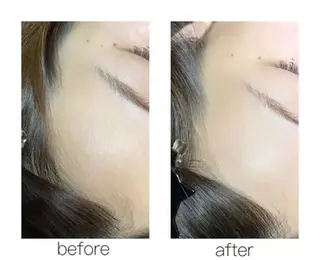 トータルサロンRuby所属・【医療提携】小顔 整体ハーブピーリングのその他イメージ