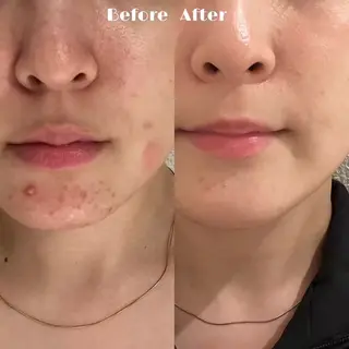 # fu♡のエステ・リラクイメージ