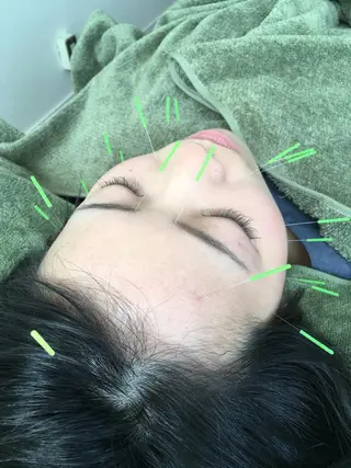 【パーソナル鍼灸】 Pintのエステ・リラクイメージ