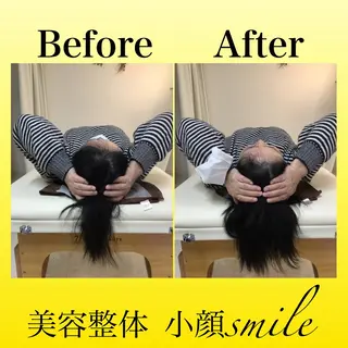 【小顔矯正専門】 小顔smileのエステ・リラクイメージ
