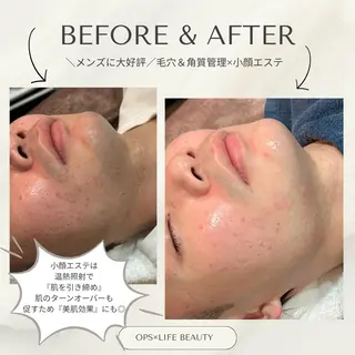 メンズ OPS×LIFE BEAUTY/maiのエステ・リラクイメージ