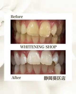 ホワイトニングショップ静岡葵区店所属・ホワイトニング ショップ葵区静岡駅店のその他イメージ