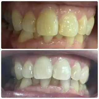 メンズ LOVEホワイト ニング恵比寿店のその他イメージ